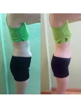 ラディアンス/貼るだけデトックス！