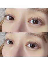 ニム(nim)/Lash lift