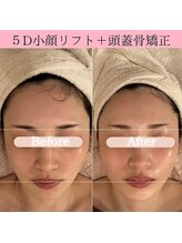 ココロ(COCORO)/小顔矯正&頭蓋骨矯正