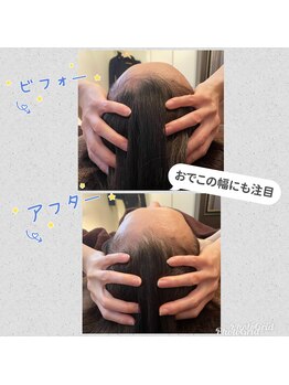 アモリール麻布十番(Amolir)/頭蓋骨小顔矯正