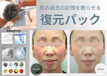 エングロー(Englow)