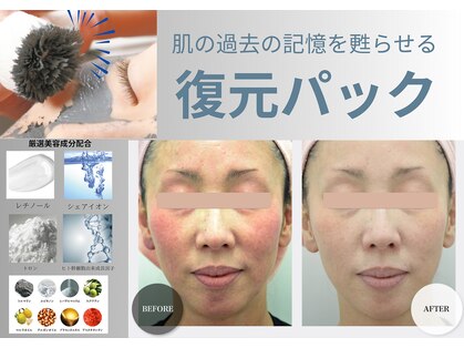 エングロー(Englow)の写真