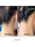 女性新規◆難しい所はプロが解決!うなじWAX（通常価格¥4000）