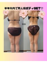 ルミルナ(Lumi Luna)/３０代ダイエット