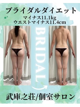 エデン(Eden)/ブライダルエステ★全身痩身