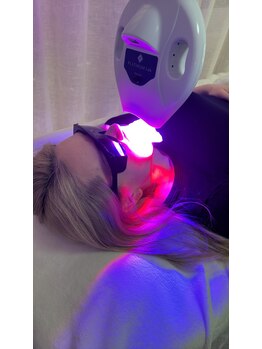 グリッター ショウナン(glitter. SHONAN)/ホワイトニング2回目のお客様