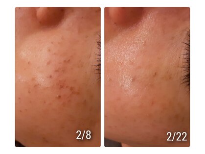 レイブルーノ(RayBruno)の写真