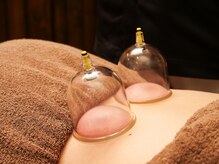 のぐち鍼灸整骨院の雰囲気(整体+カッピングで筋肉とリンパの流れを良くします。)