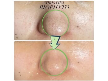 ちらちゅら/クリスティーナ【施術経過】