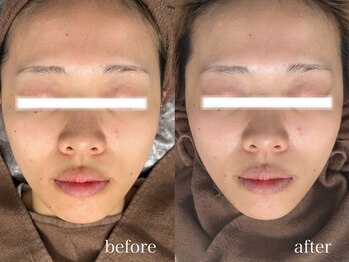 フェイン 青山店(fein.)/トーンアップが期待できます!