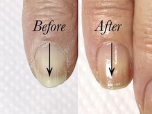 トゥインクリーネイルサロン(Twinkly Nail Salon)/【最強のネイルケア】1回お試し
