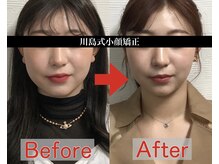 アベックトア(Avectoi)