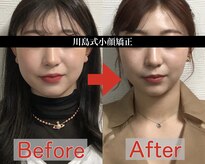 アベックトア(Avectoi)