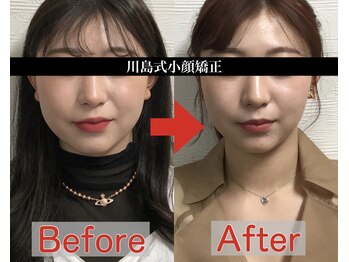 アベックトア(Avectoi)