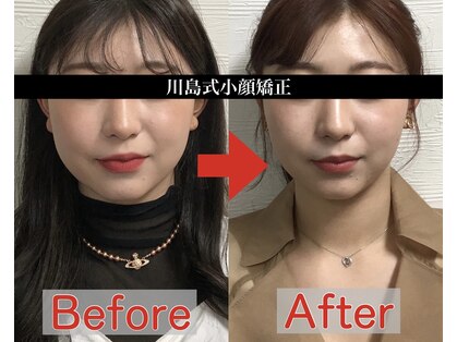 アベックトア(Avectoi)の写真