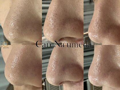 ケアナ 梅田店(CareNa)の写真