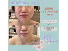 ビューティーサロン セガール(segar)の雰囲気（レモンボトルフェイシャルが一押し！）