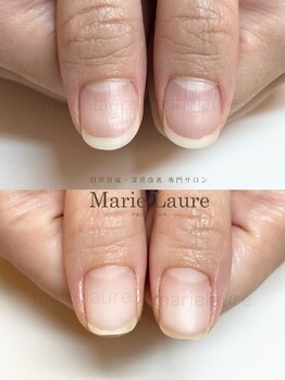 マリーロール 淀屋橋本店(Marie Laure)/深爪矯正/自爪育成/ネイルケア