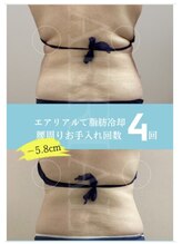 エアリアル 八代店/脂肪冷却