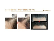 ザ フロウ(THE flow)/効果絶大★韓国発の頭皮管理