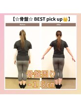 えのもと美容整体院/【骨盤矯正＋ダイエット】
