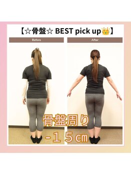 えのもと美容整体院/【骨盤矯正+ダイエット】