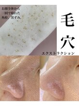 アンド リュクス(& Luxe)/ポツポツ毛穴ケア