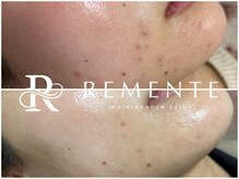 モテ 新宿店(Mote)/