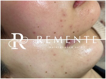 モテ 新宿店(Mote)/