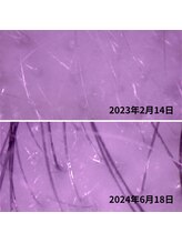 ゆう/白髪も減った