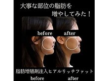 ワイズ 沖縄うるま院(Medical Y's)/今時美容は脂肪増減コントロール