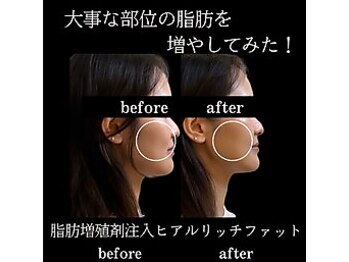 ワイズ 沖縄うるま院(Medical Y's)/今時美容は脂肪増減コントロール