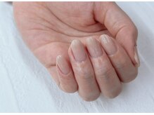 ビーエスネイル 金山店(bs-nail)/剥離した爪がキレイに見える