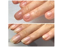 アンドミイ ネイル(…&me nail)