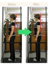 かとう整骨院/ビフォーアフター（全身矯正）