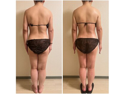 アビヤンガの写真