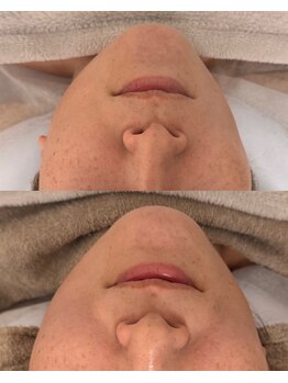 サロンミー(salon Mii)/