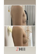 エルミナ.(elmina.)/自分の脂肪細胞を増やす！