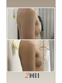 エルミナ.(elmina.)/自分の脂肪細胞を増やす！