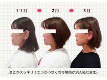 ナチュラルハリー(NaturalHarry)の雰囲気（エラ張り横顔にお悩みの方へ！月２回の小顔ケアで4ヶ月で激変☆）