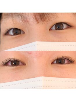 プライベイトスペース コト(PRIVATE SPACE COTO)/ダブルアイリフト