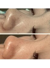 ノノサロン(nono salon)/