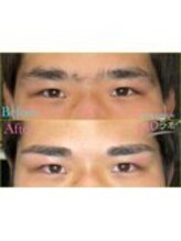 MDラボ 小松清六店/before after