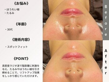 ルディラ 銀座店/スポットフィット