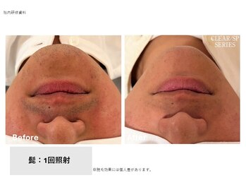 シズク ビューティーサロン(SHIZUKU beauty salon )/