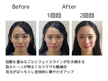 オリナ(olina)/-before & after-