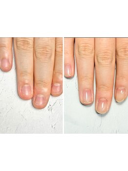 爪の悩みを解消できる（ケア含む）