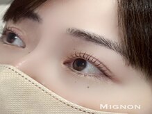 ミニョン(Mignon)