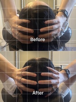 ミームスパ 梅田中崎町(Meem Spa)/【龍の手ヘッドスパ】