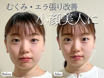 リン 吉祥寺店(Rin)